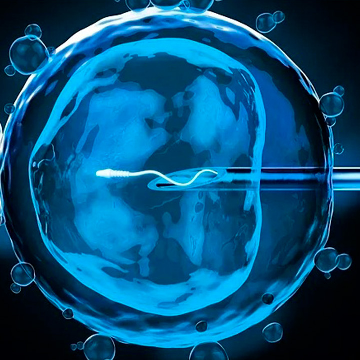 Procedimiento de la fertilizacion in Vitro