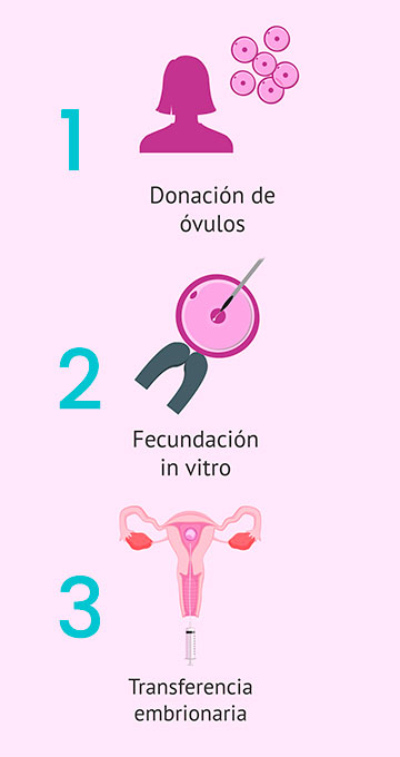 Procedieminto para ovodonacion