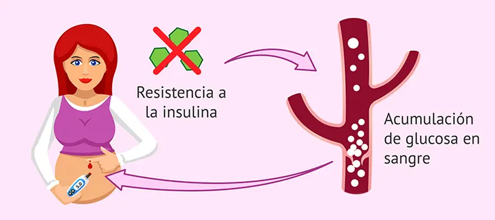 Qué es la diabetes gestacional